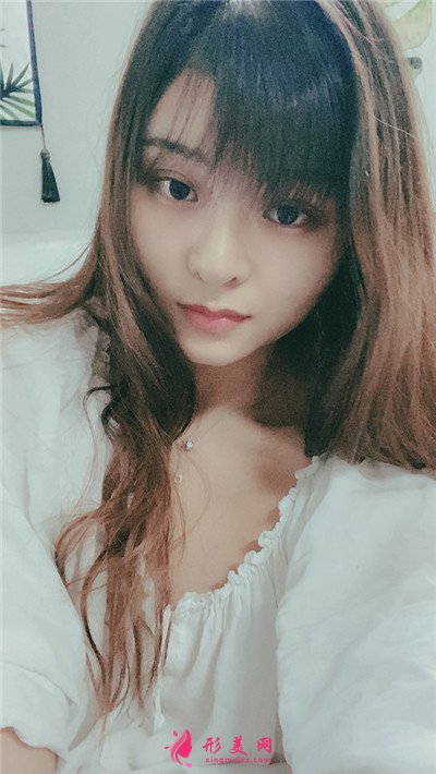 广州肋软骨隆鼻术后恢复情况对比 术后 广州肋软骨隆鼻术后恢复情况对比