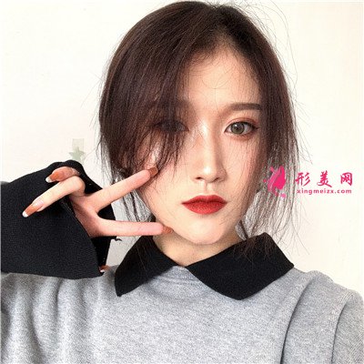 武汉小仙女全切双眼皮术后恢复情况反馈 术后 武汉小仙女全切双眼皮术后恢复情况反馈