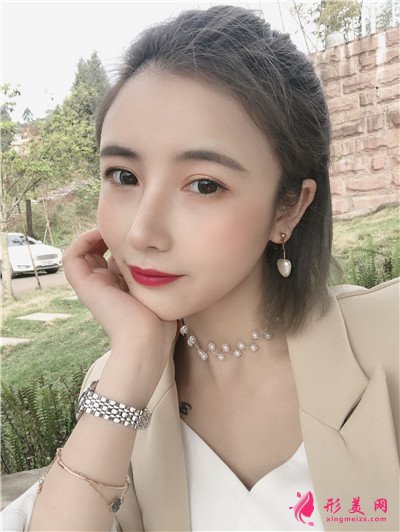 郑州鼻综合术后恢复效果对比图反馈 术后 郑州鼻综合术后恢复效果对比图反馈