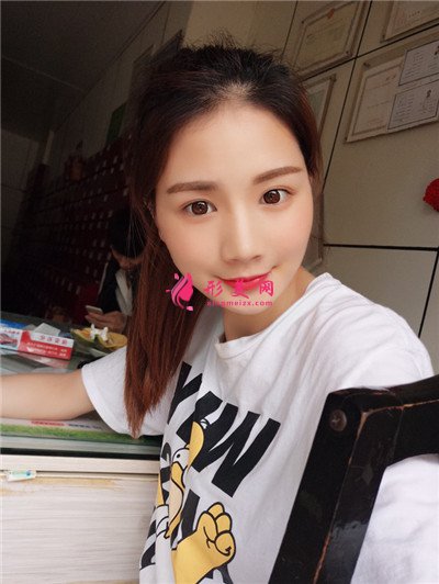 武汉自体脂肪面部填充术后效果反馈 术后 武汉自体脂肪面部填充术后效果反馈