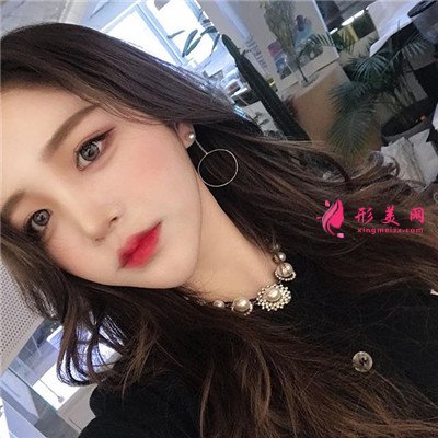 长沙眼部综合手术术后效果反馈 术后 长沙眼部综合手术术后效果反馈