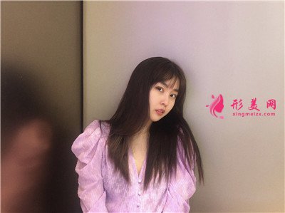 济南眼部综合手术术后效果展示