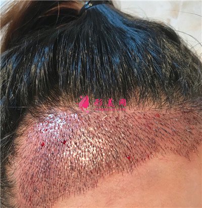 ab7352fd538a-audio.jpg ab7352fd538a-audio.jpg