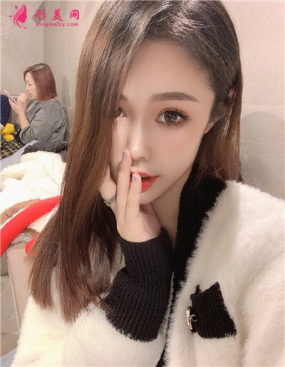 长沙肋软骨隆鼻术后恢复情况展示 术后 长沙肋软骨隆鼻术后恢复情况展示