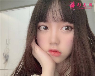 北京眼部综合手术术后恢复效果对比 术后 北京眼部综合手术术后恢复效果对比