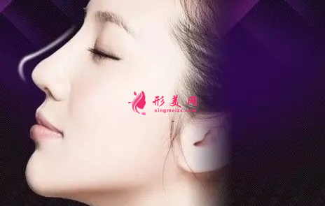 自体软骨隆鼻时间长了要更换吗