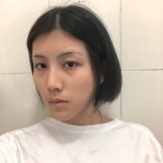 四川娇点医学美容医院做面部填充怎么样？