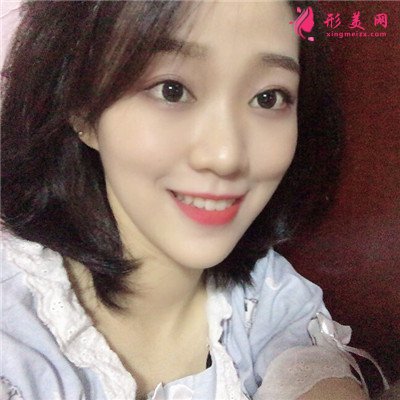 杭州面部埋线提升术后恢复情况对比