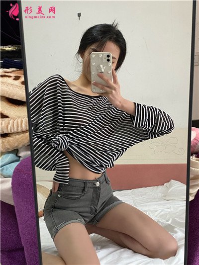 武汉小姐姐腰腹吸脂术后恢复情况分享 术后 武汉小姐姐腰腹吸脂术后恢复情况分享