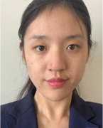 郑州缔莱美杨胜发医生做的肋软骨隆鼻，大家看看杨医生技术怎么样