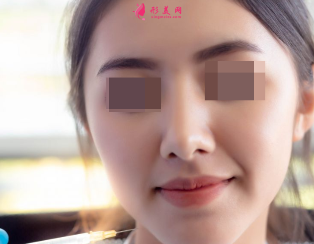 自体脂肪填充脸部费用大约是多少