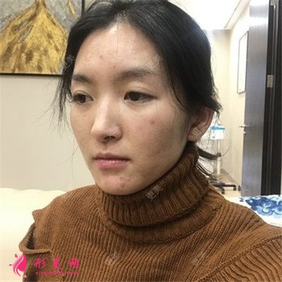 d96a732f8ba0-half.jpg d96a732f8ba0-half.jpg