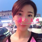 botox瘦腿针的价格是多少?有哪些优势?