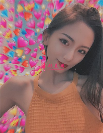 长沙小仙女肋软骨隆鼻术后效果分享 术后 长沙小仙女肋软骨隆鼻术后效果分享