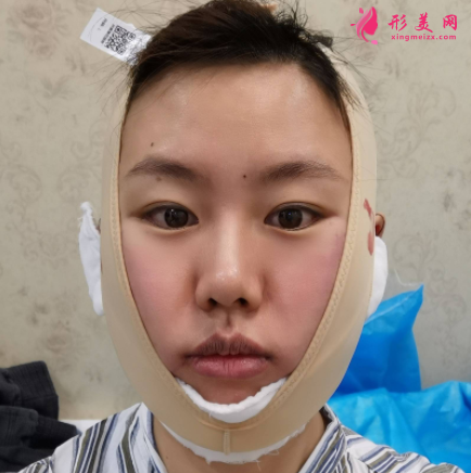 1621413385361035.png 1621413385361035.png