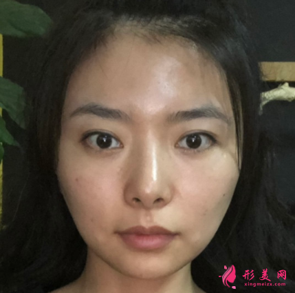 1621327429793668.png 1621327429793668.png