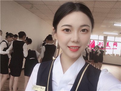 广州小姐姐面部线雕提升术后效果对比 术后 广州小姐姐面部线雕提升术后效果对比