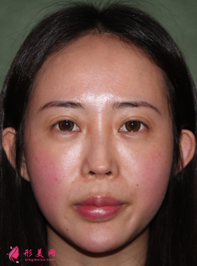 1598255257358504.png QQ截图20200824152801_resized.png