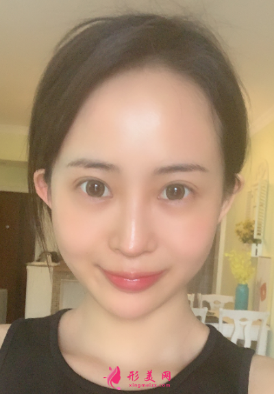 1598255271942209.png QQ截图20200824154414_resized.png