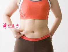 腰腹部吸脂减肥是怎么收费的？