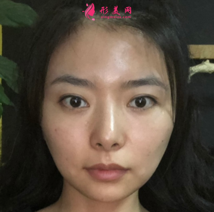 1621327429793668.png 1621327429793668.png