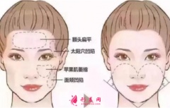 自体脂肪填充脸部后需要注意什么？
