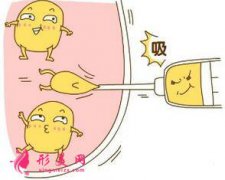 吸脂减肥术后的效果好吗？