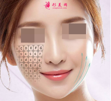 激光除皱一般需要多少钱