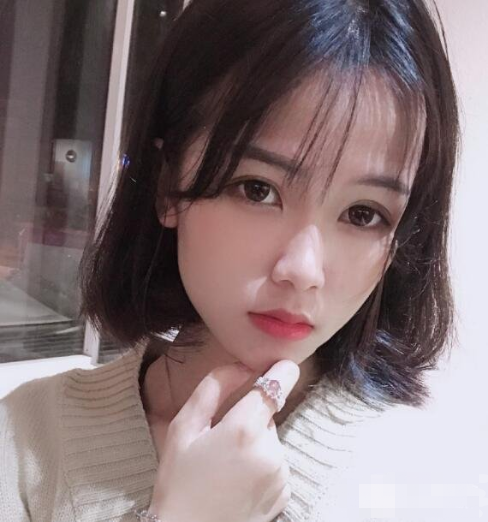 上海九院颧骨内推多少钱？全新价格表来袭！附案例分享