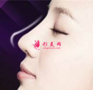 软骨隆鼻术前需要做什么准备？