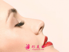 自体软骨隆鼻效果可以长久保持吗？