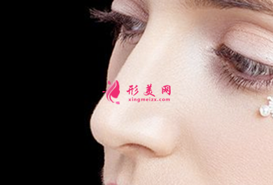 自体软骨隆鼻能保持多久时间
