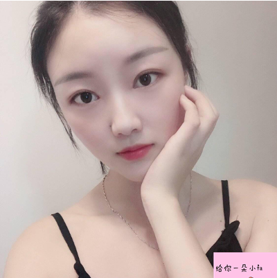 上海九院整形科苏薇洁双眼皮怎么样？真实案例和价格表一起瞧瞧~