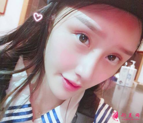 武汉同济医院整形科隆鼻怎么样?附术后案例及价格表一览~