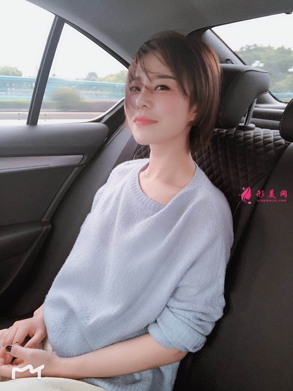 上海华美医疗美容医院徐文龙医生膨体隆鼻案例-整容案例 上海华美医疗美容医院徐文龙医生膨体隆鼻案例