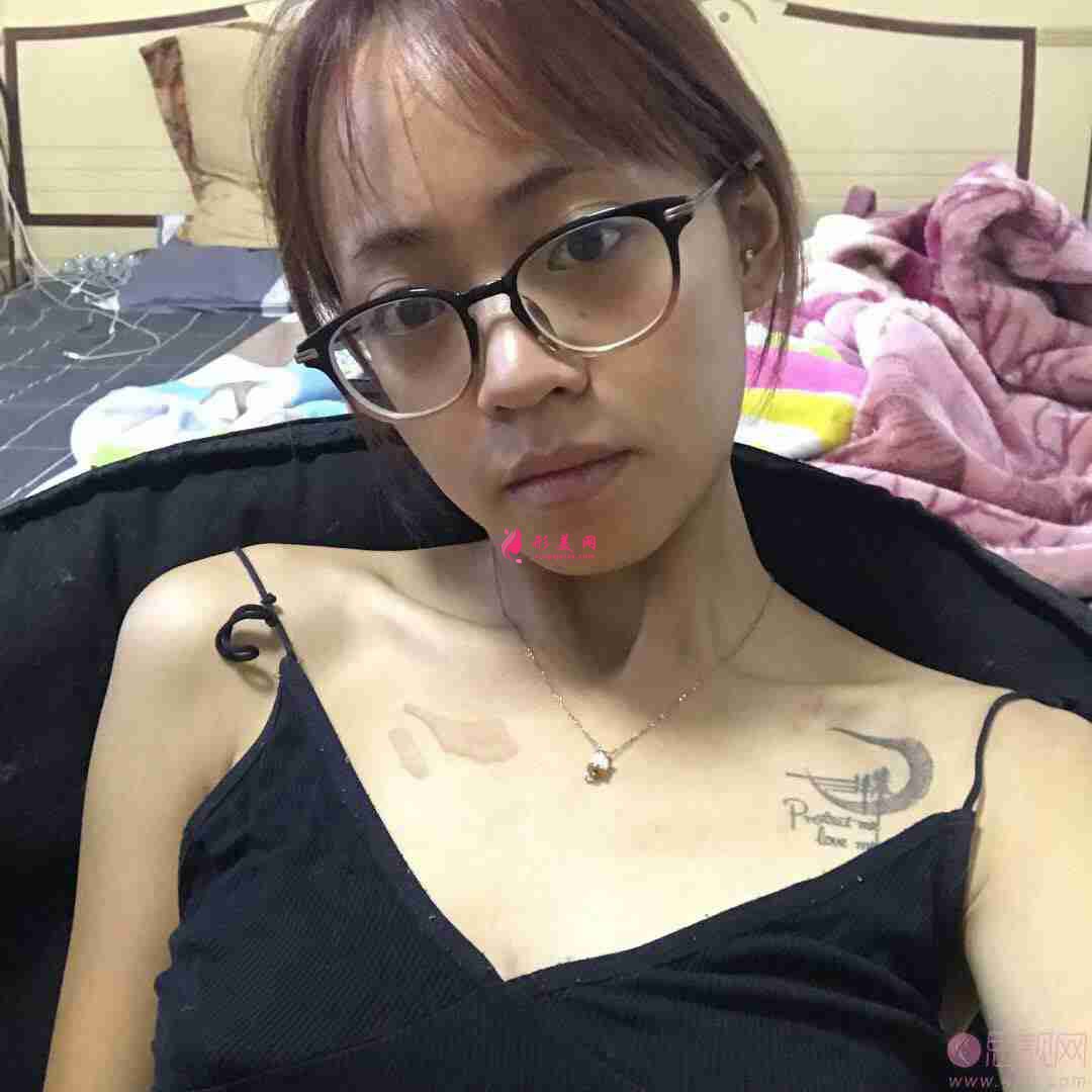 四川友谊整形美容科疤痕修复怎么样?附2020价格表详情一览