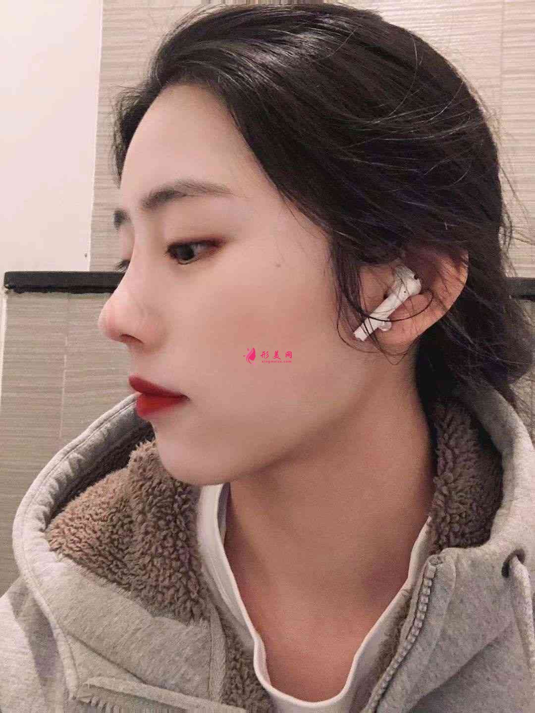 重庆星荣整形外科医院隆鼻怎么样?附隆鼻案例及2021价格表一览