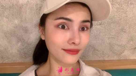 南昌时光整形是三甲医院吗?附玻尿酸隆鼻效果对比及2021价格表发布 南昌时光整形是三甲医院吗?附玻尿酸隆鼻效果对比及2021价格表发布