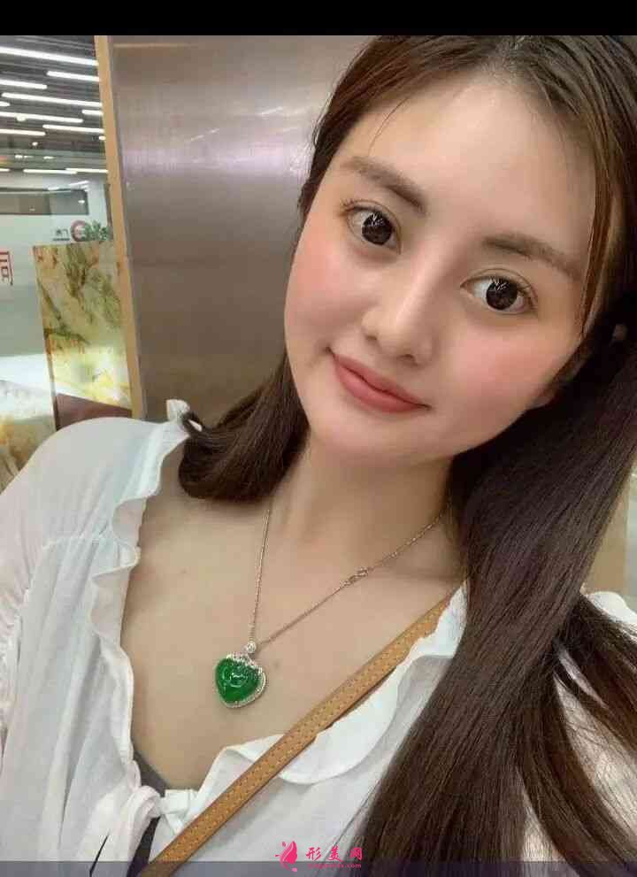 北京画美医疗美容医怎么样?2021价格表公布+玻尿酸丰唇案例分享 北京画美医疗美容医怎么样?2021价格表公布+玻尿酸丰唇案例分享