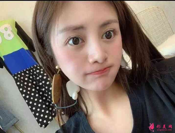 北京画美医疗美容医怎么样?2021价格表公布+玻尿酸丰唇案例分享 北京画美医疗美容医怎么样?2021价格表公布+玻尿酸丰唇案例分享