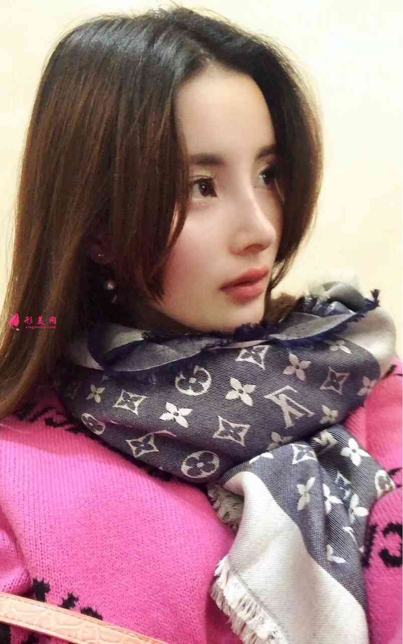 北京壹加壹医院正规吗?附隆鼻案例及2021价格表发布 北京壹加壹医院正规吗?附隆鼻案例及2021价格表发布