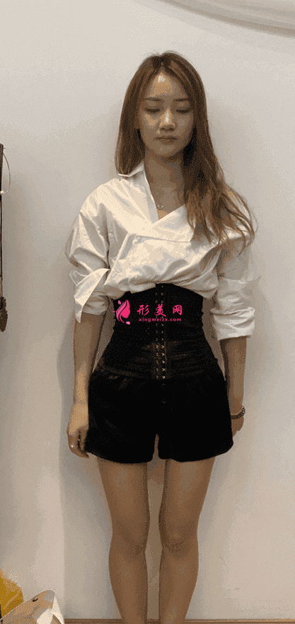 沈阳军区总医院整形科属于公立医院吗?附吸脂案例及2021价格表公开 沈阳军区总医院整形科属于公立医院吗?附吸脂案例及2021价格表公开