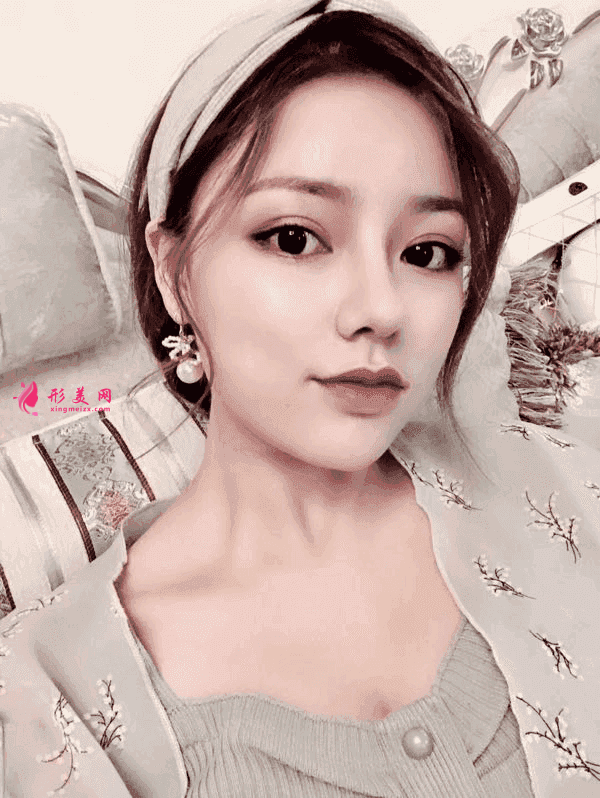 北京八大处隆鼻价格表一览及隆鼻真人案例分享