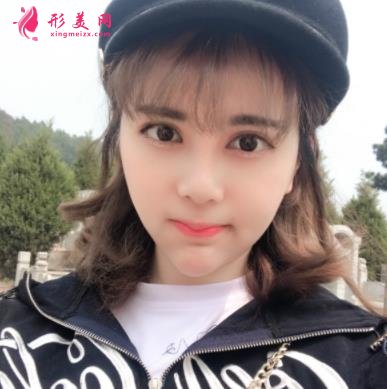 上海长征医院整形科面部吸脂怎么样?术后瘦脸效果跟美颜相机说再见!