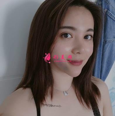 上海长征医院整形科面部吸脂怎么样?术后瘦脸效果跟美颜相机说再见!