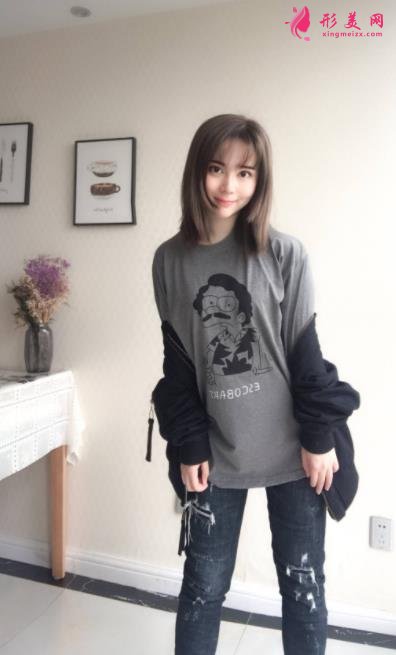 上海长征医院整形科面部吸脂怎么样?术后瘦脸效果跟美颜相机说再见!