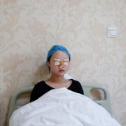 包头一附院整形科怎么样?双眼皮案例实拍对比~术后效果很不一般