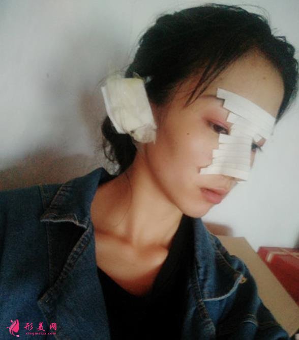 武汉同济医院整形科（公立）价格收费标准更新！隆鼻案例全面公开~