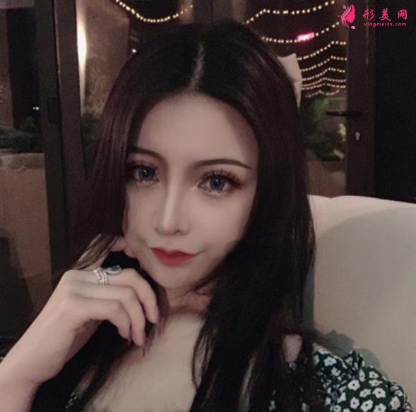 南京友谊医院整形科隆鼻案例术后恢复过程分享！含全新医美价格表