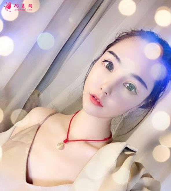 威海市立医院眼综合怎么样？术后两个月恢复效果分享